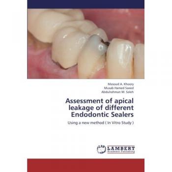 Assessment of apical leakage of different Endodontic Sealers: Using a new method