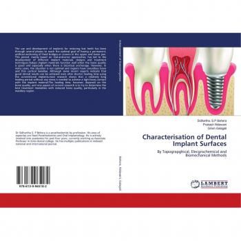 Characterisation of Dental Implant Surfaces