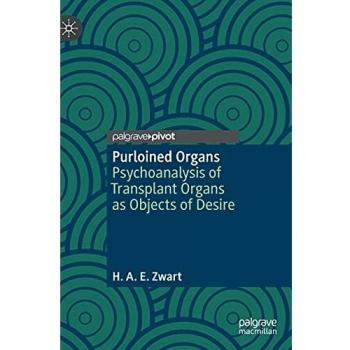 Purloined Organs
