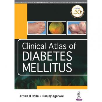 Agarwal, Sanjay: Clinical Atlas of Diabetes Mellitus