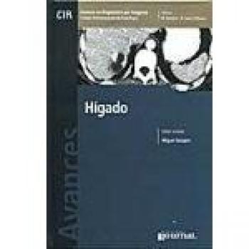 CIR, AVANCES EN DIAGNOSTICO POR IMAGENES. HIGADIO