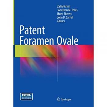 Patent Foramen Ovale