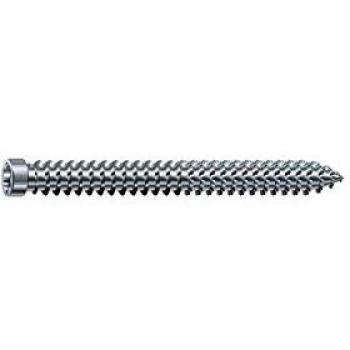 Ancoratore Infissi Spax WIROX 7,5 mm × 210 mm – 100 pezzi (Profi Box)