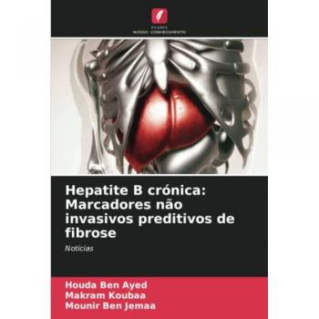 Hepatite B crónica: Marcadores não invasivos preditivos de fibrose: Notícias
