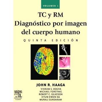 TC y RM. Diagnóstico por imagen del cuerpo humano (Tapa dura).