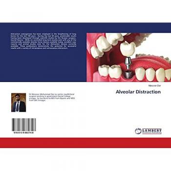 Alveolar Distraction