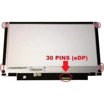 Acer LCD-Bedienfeld, Notebook Ersatzteile