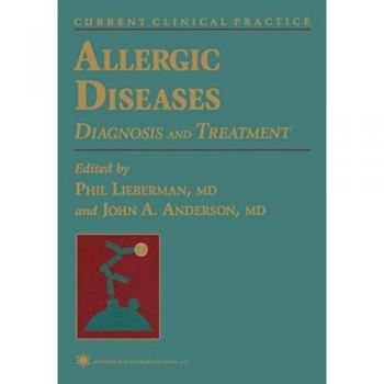 Allergic Diseases: Diagnosis and Treatment