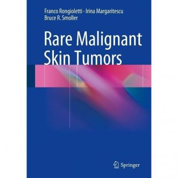 Vitalsource Technologies, Inc. Rare Malignant Skin Tumors