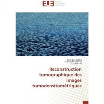 Reconstruction tomographique des images tomodensitométriques