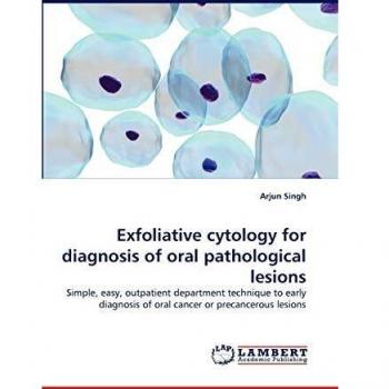 Exfoliative cytology for diagnosis of oral pathological lesions: Simple, easy, outpatient department technique to early diagnosis of oral cancer or precancerous lesions