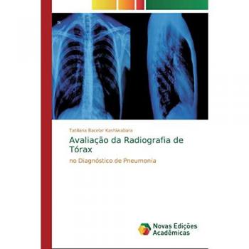Avaliação da Radiografia de Tórax: no Diagnóstico de Pneumonia