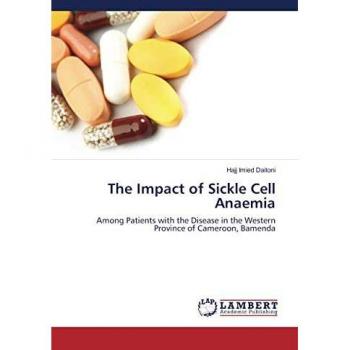 The Impact of Sickle Cell Anaemia: Among Patients with the Disease in the Western Province of Cameroon, Bamenda
