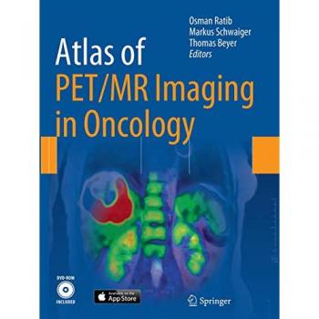 Atlas of PET/MR Imaging in Oncology, Fachbücher von Thomas Beyer, Markus Schwaiger, Osman Ratib