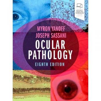 Ocular pathology