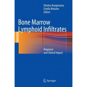 Bone Marrow Lymphoid Infiltrates: Diagnosis and Clinical Impact