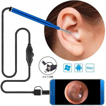 Kit de otoscopio inteligente USB para eliminación de cera