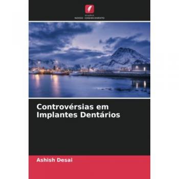 Controvérsias em Implantes Dentários