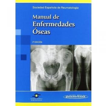 Manual Enfermedades Oseas.