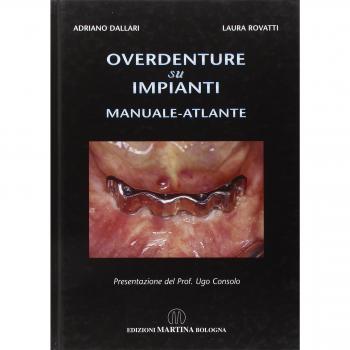 Overdenture su impianti. Manuale atlante