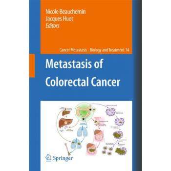 Metastasis of Colorectal Cancer