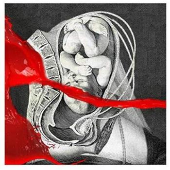 IAMX
