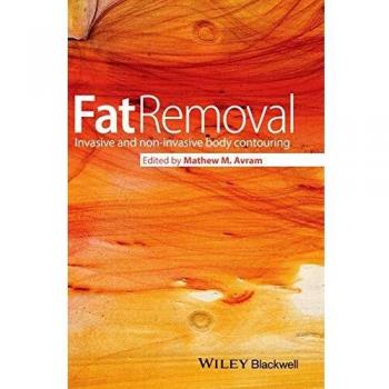 Fat Removal