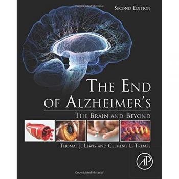 The End of Alzheimer's: The Brain and Beyond
