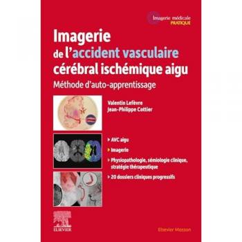 Imagerie de l'accident vasculaire cérébral ischémique aigu