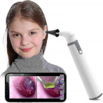 Otoscopio digital inalámbrico Niuniu
