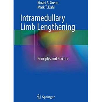 Intramedullary Limb Lengthening: Principles and Practice