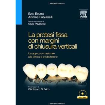 La protesi fissa con margini di chiusura verticali
