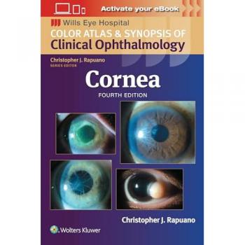 Cornea: Print + eBook with Multimedia