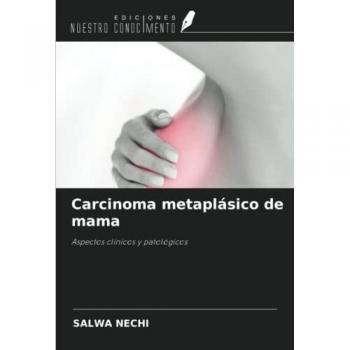 Carcinoma metaplásico de mama: Aspectos clínicos y patológicos