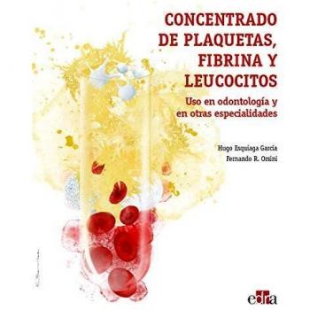 CONCENTRADO DE PLAQUETAS FIBRINA Y LEUCOCITOS