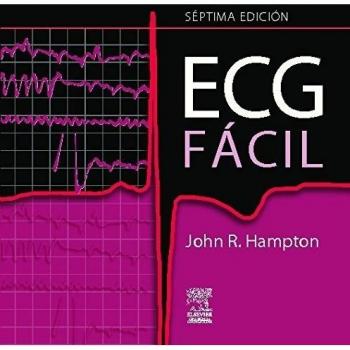 ECG fácil