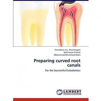 Preparing curved root canals
