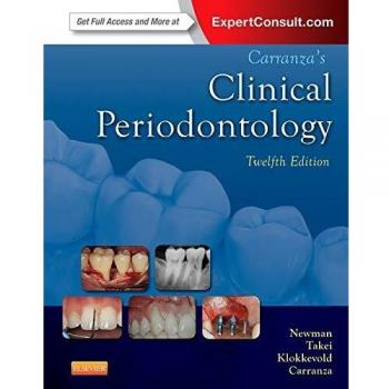 Carranza's Clinical Periodontology, 12e (Expert Consult Title: Online + Print