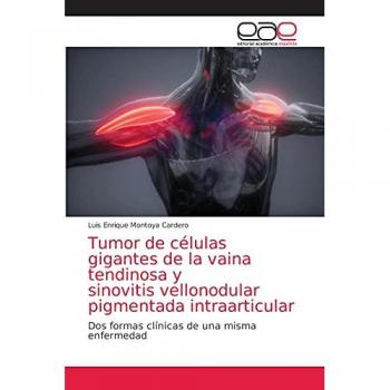 Tumor de células gigantes de la vaina tendinosa y sinovitis vellonodular pigmentada intraarticular: Dos formas clínicas de una misma enfermedad