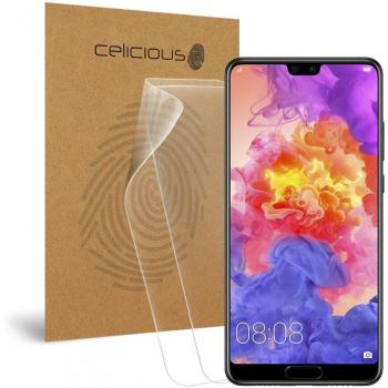 OptiMatte Glare Guard Film – Huawei P20 Set of 2