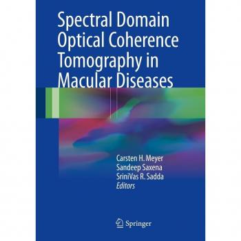 Spectral Domain Optical Coherence Tomography in Macular Diseases