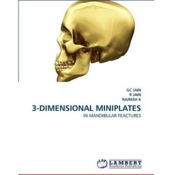 3-DIMENSIONAL MINIPLATES: IN MANDIBULAR FEACTURES