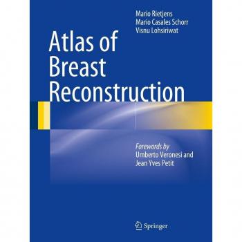 Atlas of Breast Reconstruction