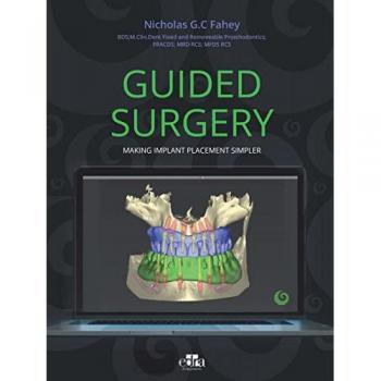 Guided surgery. Making implant placement simpler