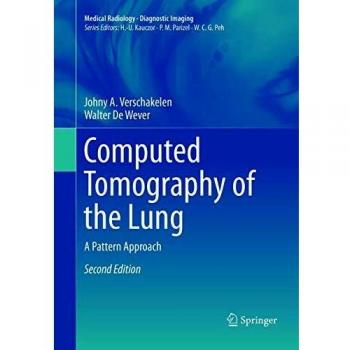 Computed Tomography of the Lung: A Pattern Approach