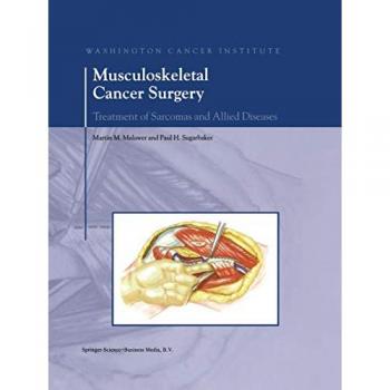 Musculoskeletal Cancer Surgery