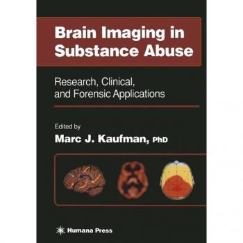 Brain Imaging in Substance Abuse