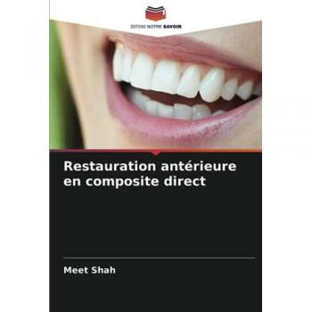 Restauration antérieure en composite direct