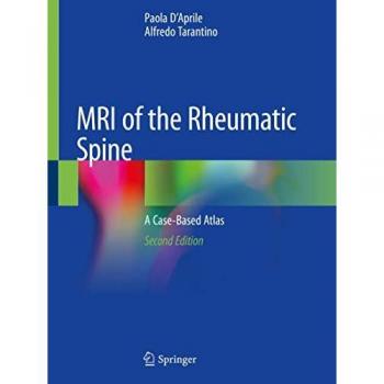 Tarantino, Alfredo: MRI of the Rheumatic Spine