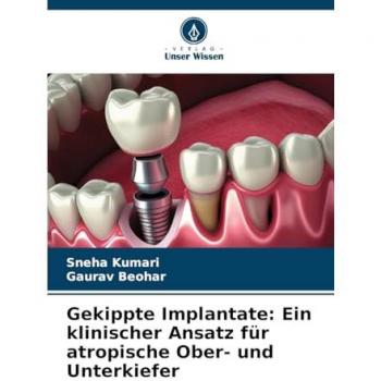 Kumari, Sneha: Gekippte Implantate: Ein klinischer Ansatz für atropische Ober